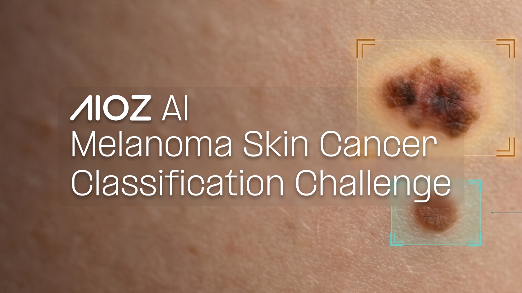 Melanoma Skin Cancer Classification Challenge