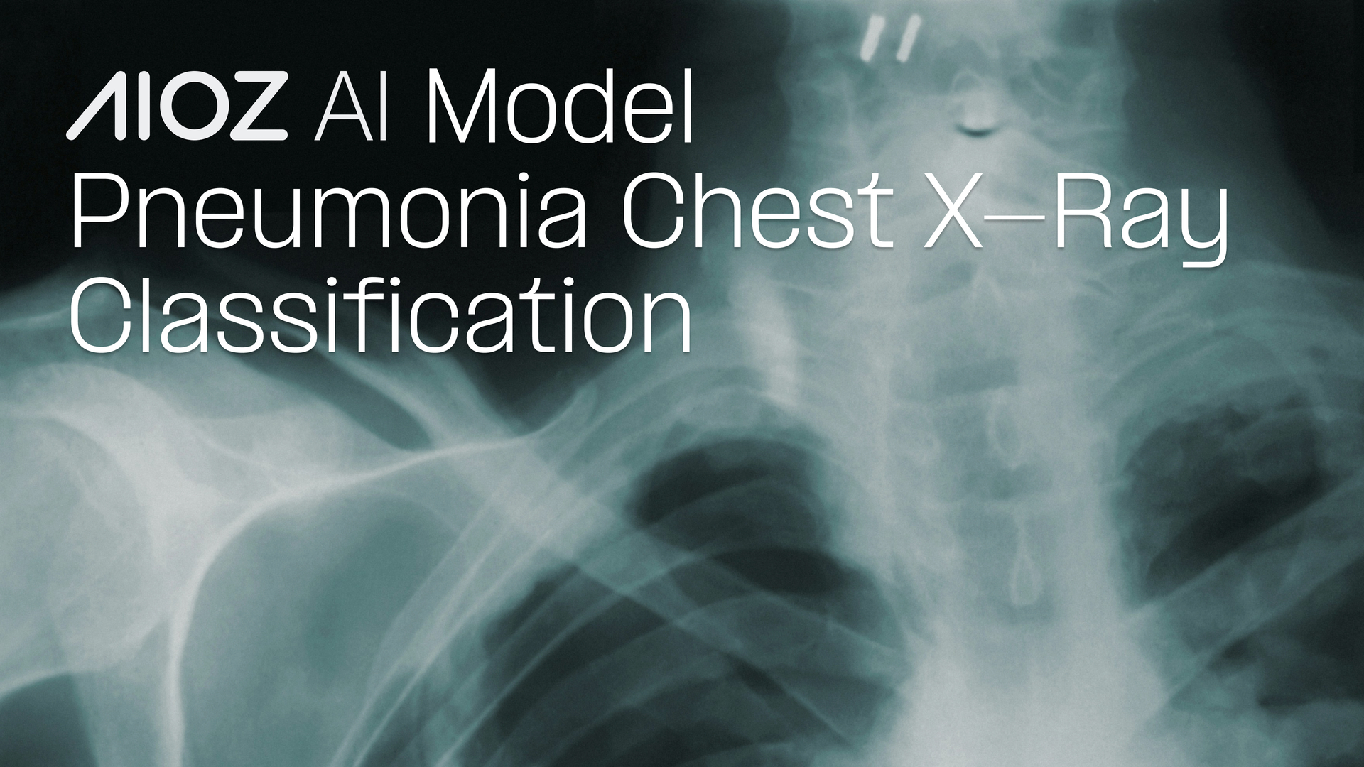 Pneumonia_Chest_X_Ray_Model