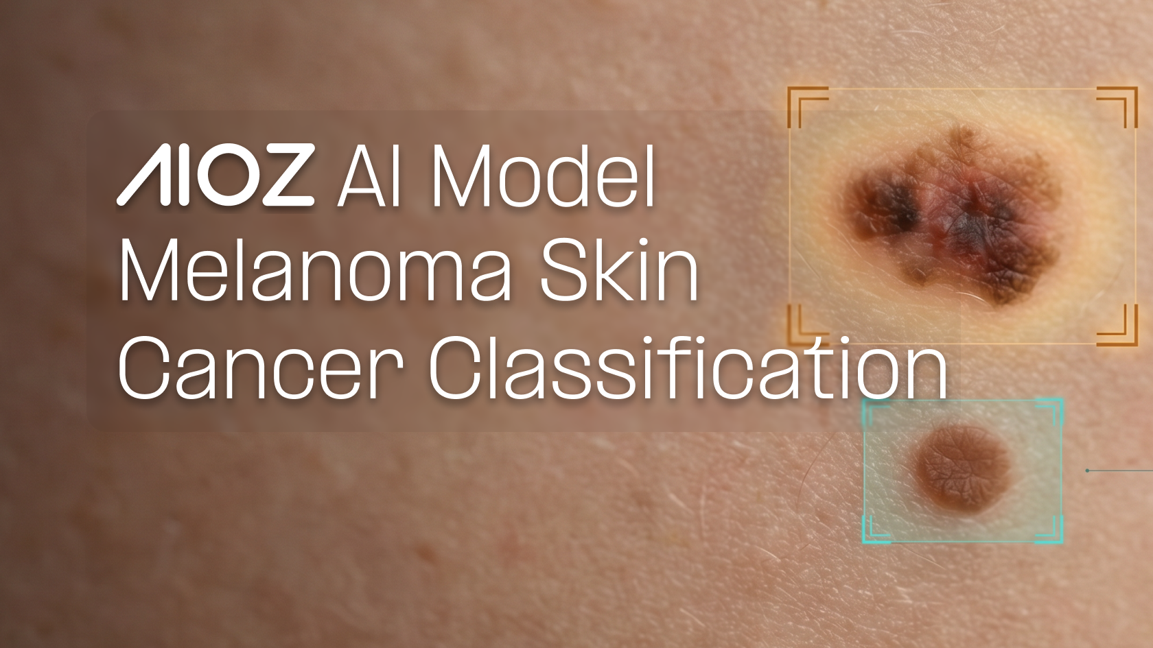 Melanoma_Skin_Cancer_Model
